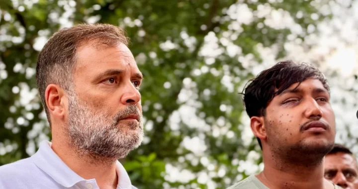 ‘यहाँ देखिए, ये है पैलेट गन…’: राहुल गांधी ने साहिल के घाव दिखा सरकार को घेरा!