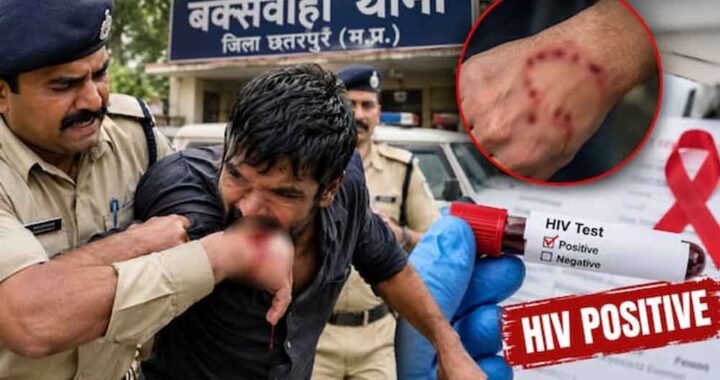 छतरपुर में रेप के आरोपी ने कांस्टेबल को काटा, मेडिकल जांच में HIV पॉजिटिव