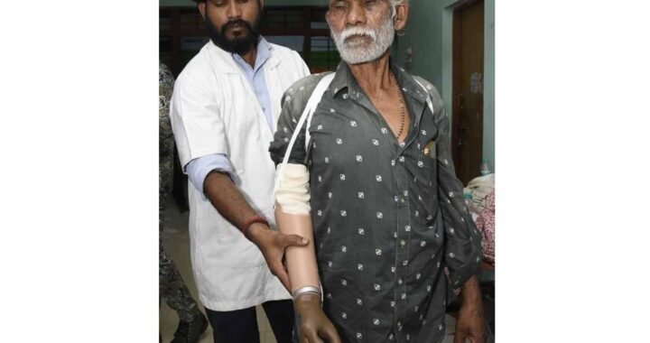 ट्रेन हादसे के दर्द पर ‘सेवा संकल्प’ का मरहम, धमतरी के तेजराम को दो घंटे में मिला कृत्रिम हाथ, लौटी जिंदगी की रंगत